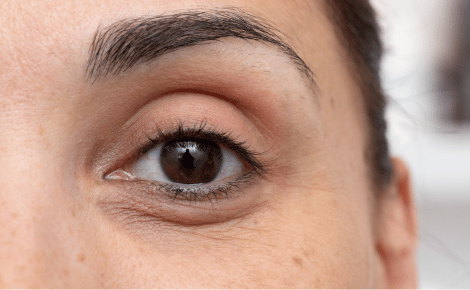Productos Para Las Ojeras